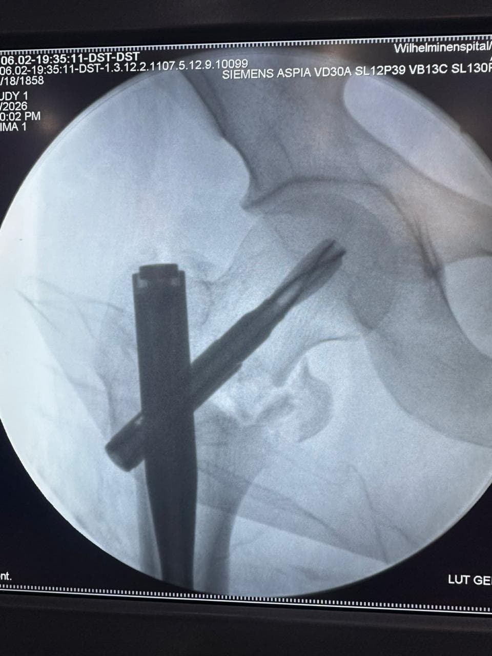 Spine care