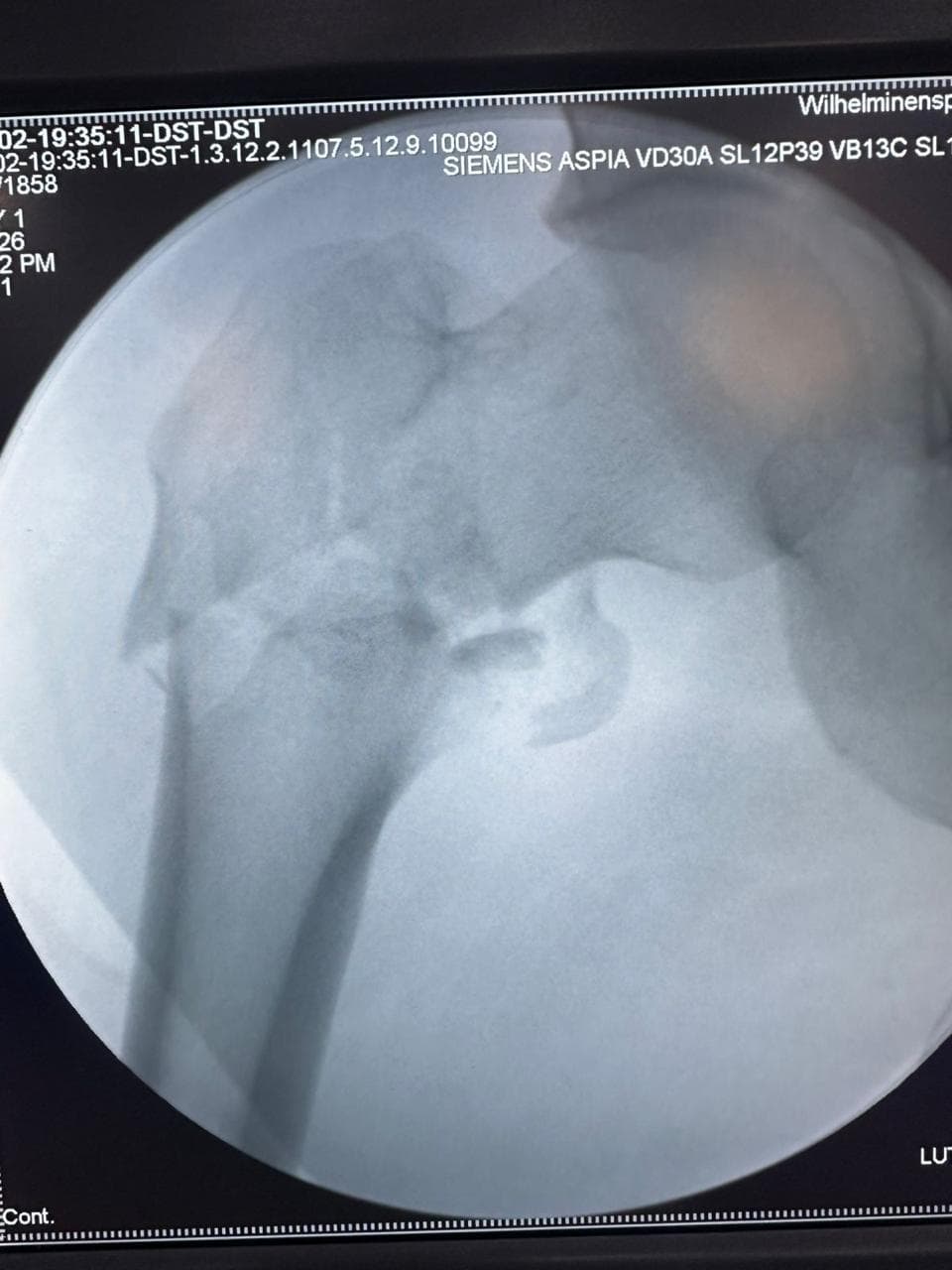 Knee surgery